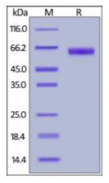 SDS-PAGE (PROCR-8575H).jpg